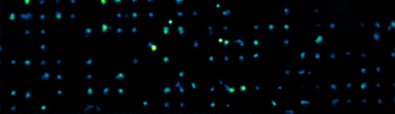 Single cells on micropattern