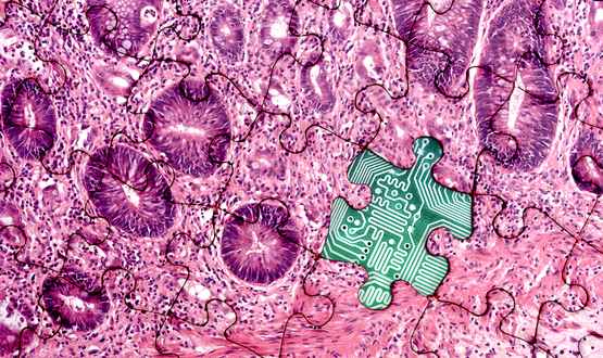 digital pathology